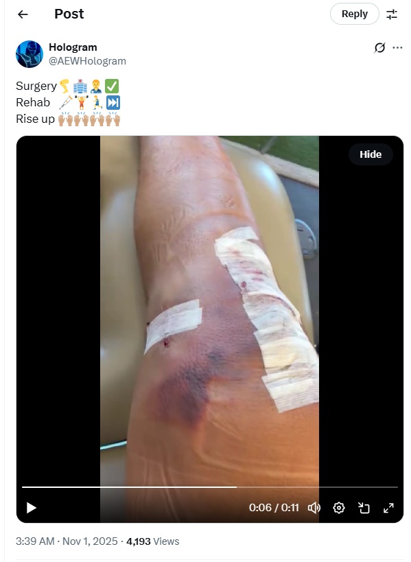 Hologram Provides Big Update On Injury